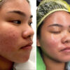 Ary Herbal Whitening Cream - Image 3