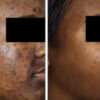 Ary Herbal Whitening Cream - Image 2